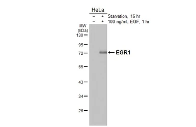 Anti-EGR1 antibody [HL5186] used in Western Blot (WB). GTX645438