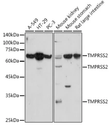 Anti-TMPRSS2 antibody used in Western Blot (WB). GTX64544