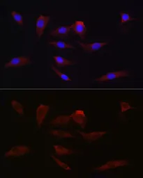 Anti-TMPRSS2 antibody used in Immunocytochemistry/ Immunofluorescence (ICC/IF). GTX64544