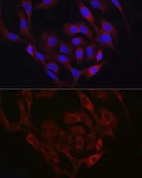 Anti-TMPRSS2 antibody used in Immunocytochemistry/ Immunofluorescence (ICC/IF). GTX64544