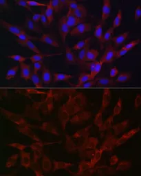 Anti-TMPRSS2 antibody used in Immunocytochemistry/ Immunofluorescence (ICC/IF). GTX64544