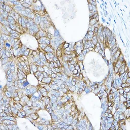 Anti-TMPRSS2 antibody used in IHC (Paraffin sections) (IHC-P). GTX64544
