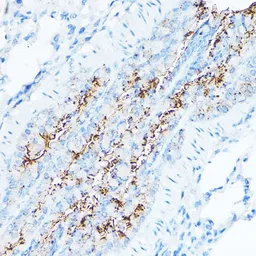 Anti-TMPRSS2 antibody used in IHC (Paraffin sections) (IHC-P). GTX64544