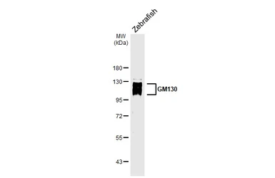 Anti-GM130 antibody [HL5191] used in Western Blot (WB). GTX645443