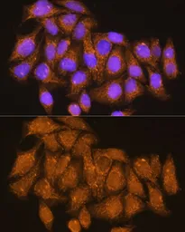 Anti-ATP6V1E1 antibody used in Immunocytochemistry/ Immunofluorescence (ICC/IF). GTX64545