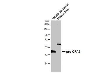 Anti-CPA2 antibody [HL5199] used in Western Blot (WB). GTX645451