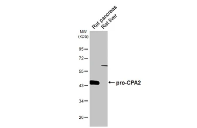 Anti-CPA2 antibody [HL5199] used in Western Blot (WB). GTX645451