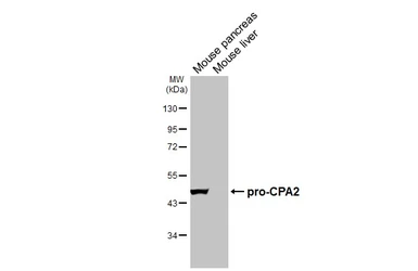 Anti-CPA2 antibody [HL5200] used in Western Blot (WB). GTX645452