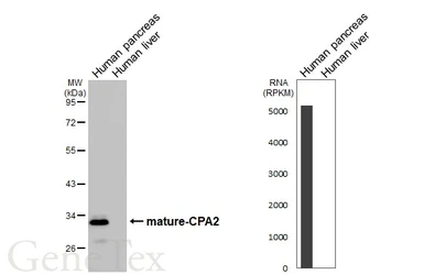 Anti-CPA2 antibody [HL5200] used in Western Blot (WB). GTX645452