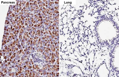 Anti-CPA2 antibody [HL5200] used in IHC (Paraffin sections) (IHC-P). GTX645452
