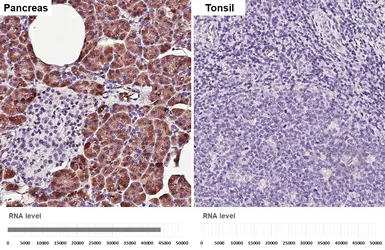 Anti-CPA2 antibody [HL5200] used in IHC (Paraffin sections) (IHC-P). GTX645452