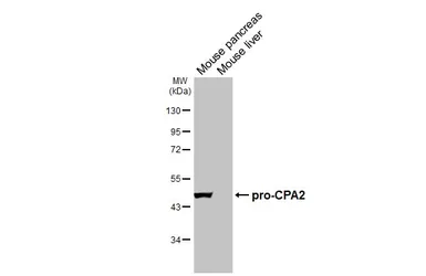 Anti-CPA2 antibody [HL5200] used in Western Blot (WB). GTX645452
