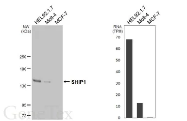 Anti-SHIP1 antibody [HL5204] used in Western Blot (WB). GTX645456