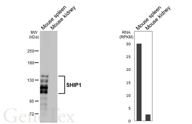Anti-SHIP1 antibody [HL5204] used in Western Blot (WB). GTX645456