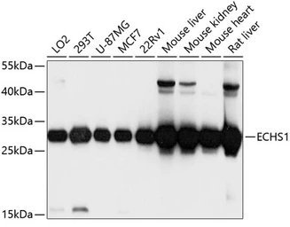 Anti-ECHS1 antibody used in Western Blot (WB). GTX64546