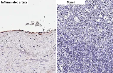 Anti-IL6 antibody [HL5207] used in IHC (Paraffin sections) (IHC-P). GTX645463