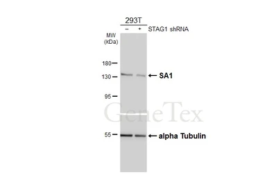 Anti-SA1 antibody [HL5212] used in Western Blot (WB). GTX645468