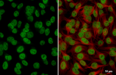 Anti-SA1 antibody [HL5212] used in Immunocytochemistry/ Immunofluorescence (ICC/IF). GTX645468