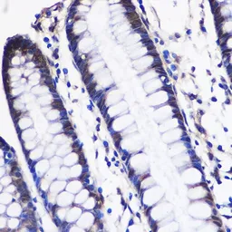 Anti-CUGBP1 antibody used in IHC (Paraffin sections) (IHC-P). GTX64547