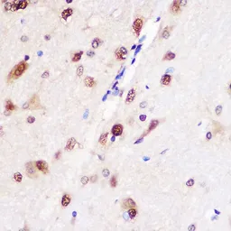 Anti-CUGBP1 antibody used in IHC (Paraffin sections) (IHC-P). GTX64547