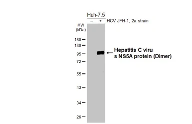 Anti-Hepatitis C virus NS5A protein antibody [HL5214] used in Western Blot (WB). GTX645470