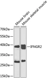 Anti-Interferon gamma Receptor 2 antibody used in Western Blot (WB). GTX64548