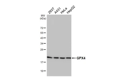 Anti-GPX4 antibody [HL5228] used in Western Blot (WB). GTX645484