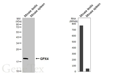 Anti-GPX4 antibody [HL5228] used in Western Blot (WB). GTX645484