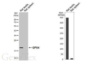Anti-GPX4 antibody [HL5228] used in Western Blot (WB). GTX645484