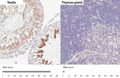 Anti-GPX4 antibody [HL5228] used in IHC (Paraffin sections) (IHC-P). GTX645484