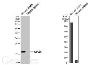 Anti-GPX4 antibody [HL5229] used in Western Blot (WB). GTX645485