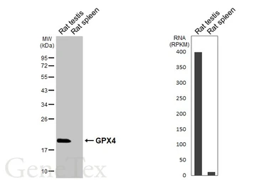 Anti-GPX4 antibody [HL5229] used in Western Blot (WB). GTX645485