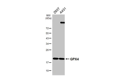 Anti-GPX4 antibody [HL5229] used in Western Blot (WB). GTX645485