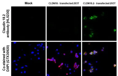 Anti-Claudin 18.2 antibody [HL5230] used in IHC-P (cell pellet) (IHC-P (cell pellet)). GTX645486