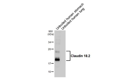 Anti-Claudin 18.2 antibody [HL5230] used in Western Blot (WB). GTX645486