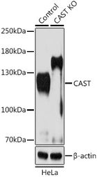 Anti-Calpastatin antibody used in Western Blot (WB). GTX64549