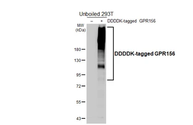 Anti-GPR156 antibody [HL5234] used in Western Blot (WB). GTX645490