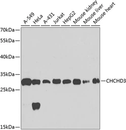 Anti-CHCHD3 antibody used in Western Blot (WB). GTX64550
