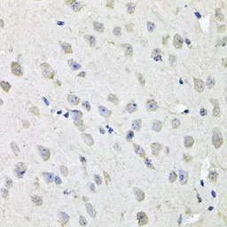 Anti-CHCHD3 antibody used in IHC (Paraffin sections) (IHC-P). GTX64550