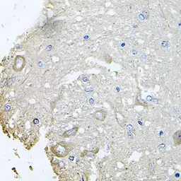 Anti-CHCHD3 antibody used in IHC (Paraffin sections) (IHC-P). GTX64550