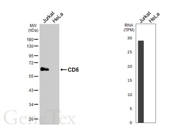 Anti-CD5 antibody [HL5247] used in Western Blot (WB). GTX645503