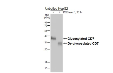 Anti-CD7 antibody [HL5248] used in Western Blot (WB). GTX645504