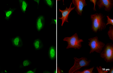 Anti-hnRNP A2B1 antibody [HL5249] used in Immunocytochemistry/ Immunofluorescence (ICC/IF). GTX645505