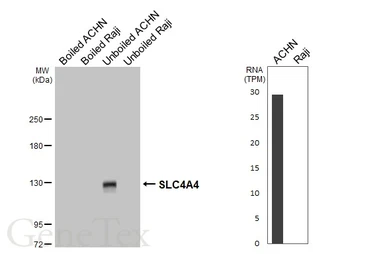 Anti-SLC4A4 antibody [HL5250] used in Western Blot (WB). GTX645506