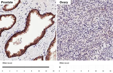 Anti-SLC4A4 antibody [HL5250] used in IHC (Paraffin sections) (IHC-P). GTX645506