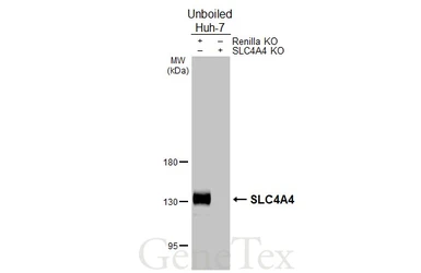Anti-SLC4A4 antibody [HL5250] used in Western Blot (WB). GTX645506