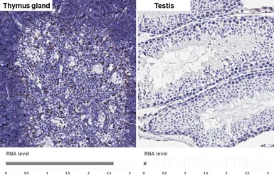 Anti-HELIOS antibody [HL5252] used in IHC (Paraffin sections) (IHC-P). GTX645508