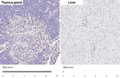 Anti-HELIOS antibody [HL5252] used in IHC (Paraffin sections) (IHC-P). GTX645508