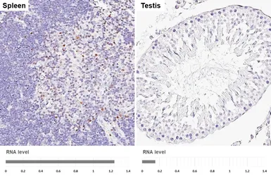 Anti-HELIOS antibody [HL5252] used in IHC (Paraffin sections) (IHC-P). GTX645508