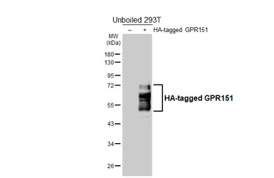 Anti-GPR151 antibody [HL5261] used in Western Blot (WB). GTX645517